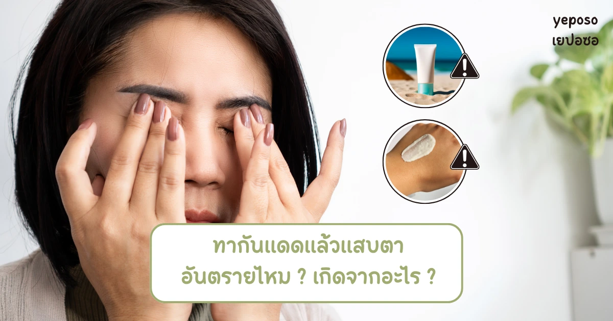 ทากันแดดแล้วแสบตา